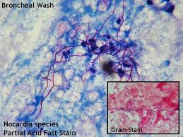 Nocardia - aspetto a microscopio